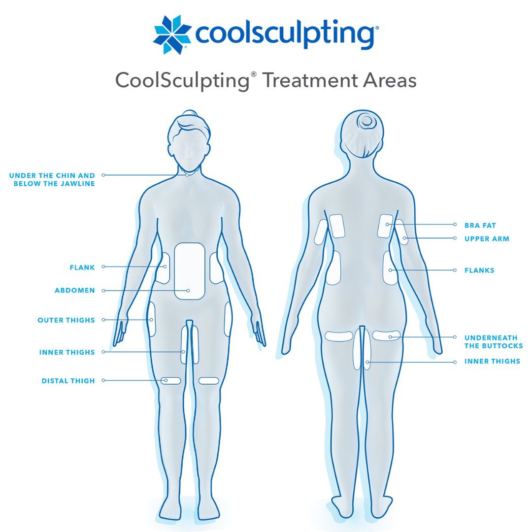 coolsculpting treatment areas Stadia Med Spa in San Antonio, TX