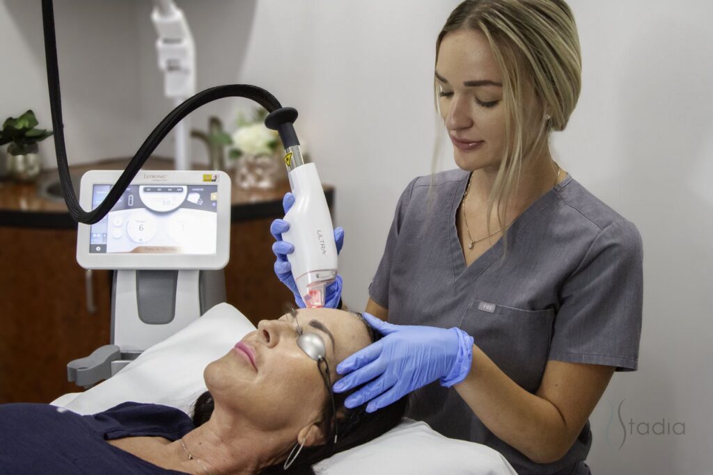 IPL skin resurfacing treatment patient at stadia med spa san antonio