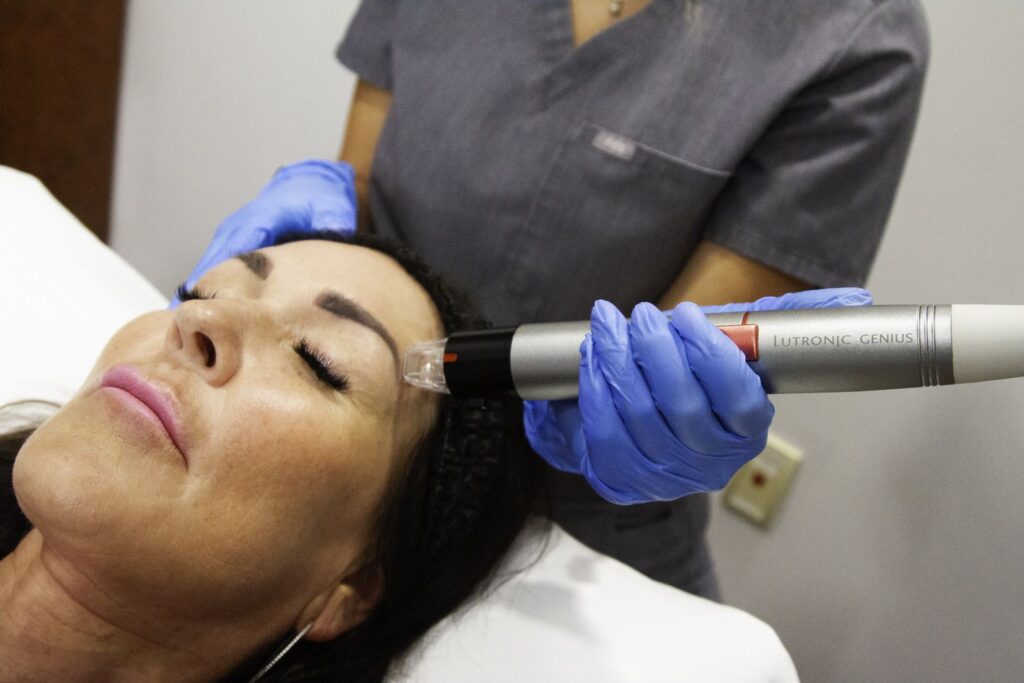 RF Microneedling actual patient treatment at Stadia Med Spa in San Antonio